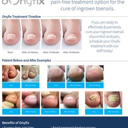 Arkady Kaplansky, DPM - Our Nail Correction System is a completely painless solution to treat ingrown toenails.