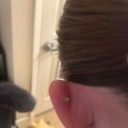 Tomahawk Tattoo - Pussing in the back and can't even see the back of my earring anymore