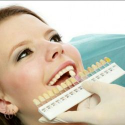 TotalBright Teeth Whitening