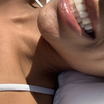 Maria-Dolores Hayeck, DDS - Post filling, beautiful work - Oral Surgeons Near Me - Coral Gables, Florida