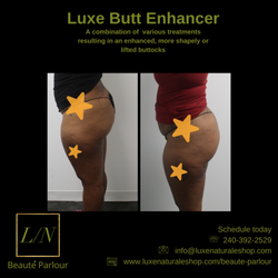Luxe Naturale - Results after 3 visits, lifted glutei.
