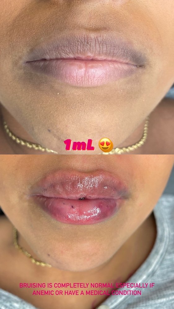 The Luxxy Lips Logo
