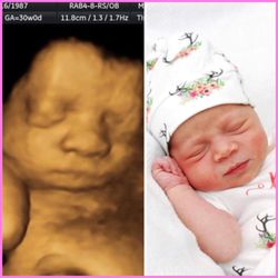 Sweet Baby O' Mine - Cutie Pie ~ Before/After