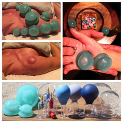 BODY WORK RENO - Cupping Therapy (aka Traditional Chinese Medicine) A Sports & Orthopedic Treatment + the variety of cups I use in my practice