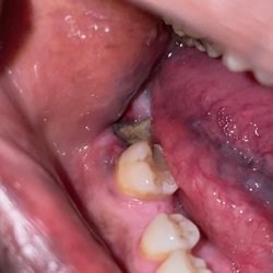 Mitchell Street Dental