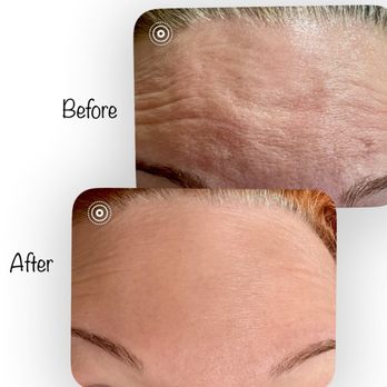Vibrant 11 Aesthetics - Medical Spas Near Me - Shelton, Washington Vibrant 11 Aesthetics - Medical Spas Near Me - Shelton, Washington