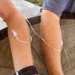 Mobile IV therapy