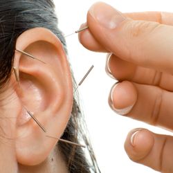 Spirit Rose Wellness - Auricular Ear Acupuncture Therapy