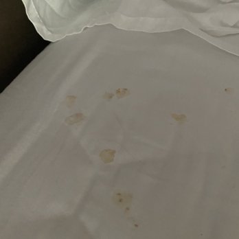 Venezia Hotel Miami Beach - Mysterious stain - Hotels Near Me - Miami Beach, Florida Venezia Hotel Miami Beach - Mysterious stain - Hotels Near Me - Miami Beach, Florida