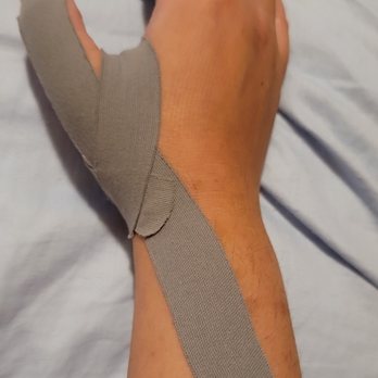 Hand Rehabilitation Specialists - Great job at kinesio taping. - Physical Therapy Near Me - Thousand Oaks, California Hand Rehabilitation Specialists - Great job at kinesio taping. - Physical Therapy Near Me - Thousand Oaks, California