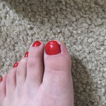 K Nails and Spa - My big toe is swollen and I can't put my shoes on. - Nail Salons Near Me - Vista, California K Nails and Spa - My big toe is swollen and I can't put my shoes on. - Nail Salons Near Me - Vista, California