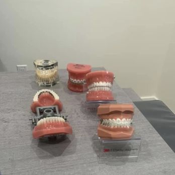 Valley Smiles Orthodontics - different types of braces he offers - Orthodontists Near Me - San Gabriel, California Valley Smiles Orthodontics - different types of braces he offers - Orthodontists Near Me - San Gabriel, California