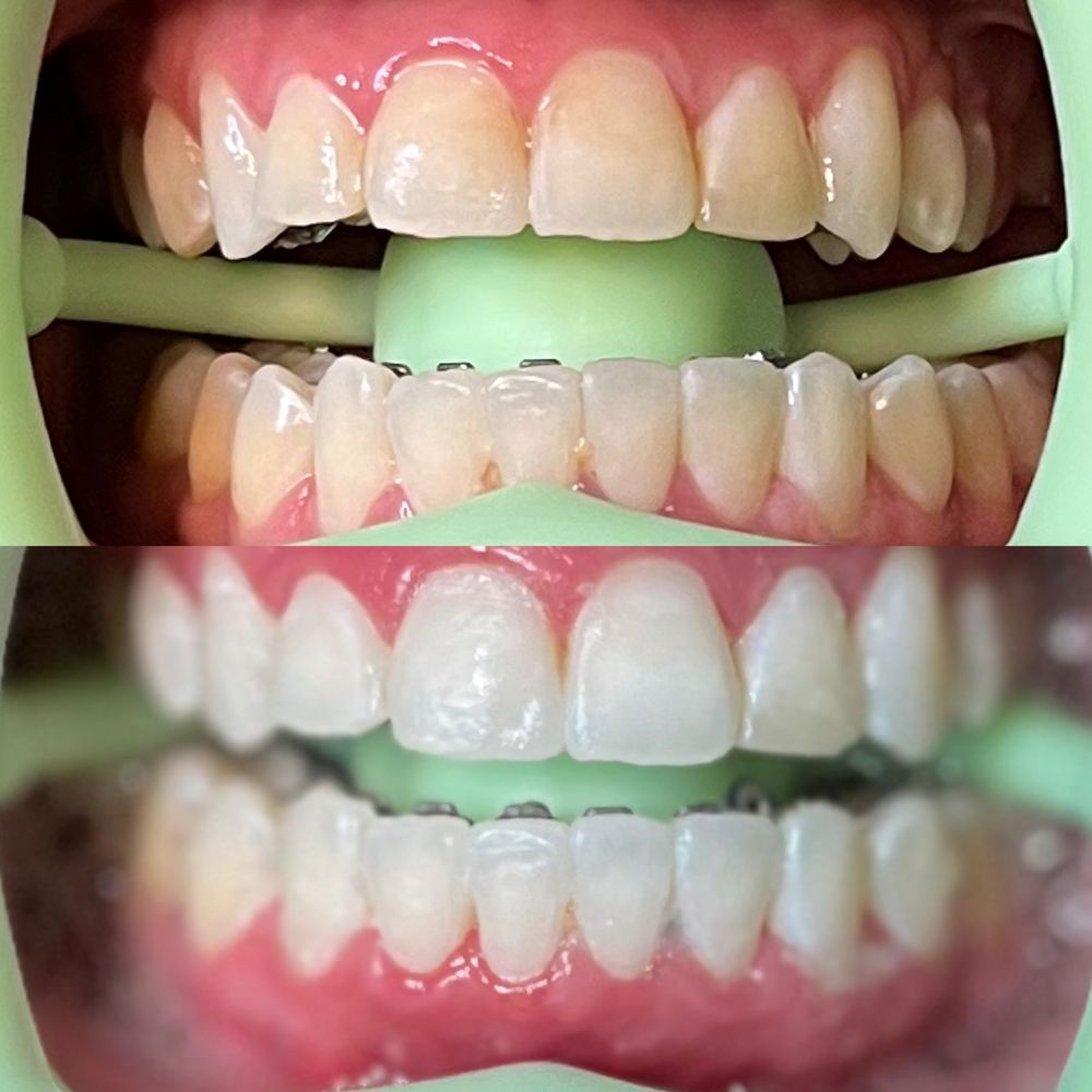 TEETH & TONIC TEETH WHITENING Request an Appointment 18 Photos