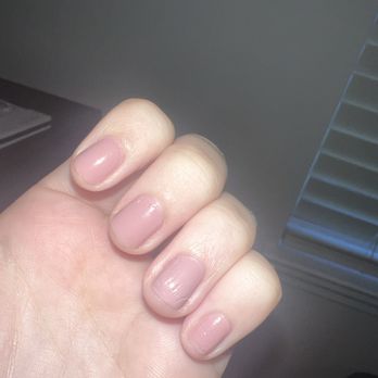 Omega Nail Boutique - This is the first hand with the messed up bottom 2 fingers. I took this less than 24 hours later. Wanted a clear picture to add. - Nail Salons Near Me - Birmingham, Alabama Omega Nail Boutique - This is the first hand with the messed up bottom 2 fingers. I took this less than 24 hours later. Wanted a clear picture to add. - Nail Salons Near Me - Birmingham, Alabama