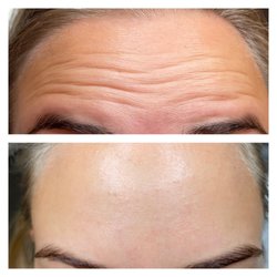 Sebastian Rose Medical Aesthetics - Botox Cardiff
