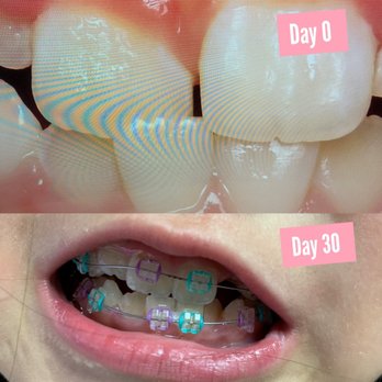 Lee Orthodontics: David Lee, DDS, MSD - Orthodontists Near Me - Concord, California Lee Orthodontics: David Lee, DDS, MSD - Orthodontists Near Me - Concord, California