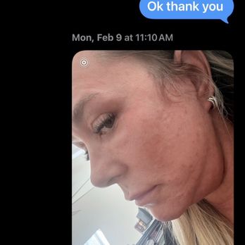 Rian A Maercks, MD - Neck results - Cosmetic Surgeons Near Me - Miami, Florida Rian A Maercks, MD - Neck results - Cosmetic Surgeons Near Me - Miami, Florida