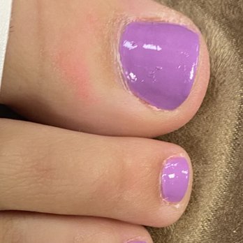 Kathy Nails and Spa - Old pink Polish on skin along with horrible paint job - Nail Salons Near Me - Huntingdon Valley, Pennsylvania Kathy Nails and Spa - Old pink Polish on skin along with horrible paint job - Nail Salons Near Me - Huntingdon Valley, Pennsylvania