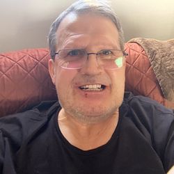 Fredericton Oral Surgery - All new bottom teeth, installed with 4 anchors.