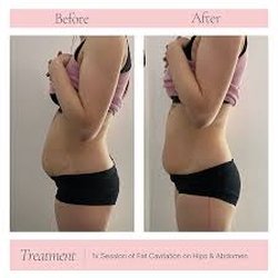 Zul Body Sculpting