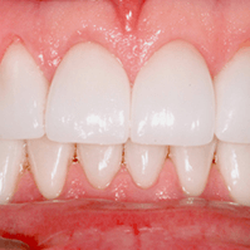 Creative Dental of Queens - Creative Dental of Queens invisalign