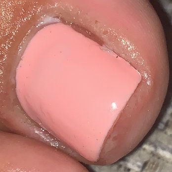 Fancy Nails - Bacteria infection from pedicure - Nail Salons Near Me - Coachella, California