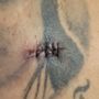 Photo of Serene Surgical