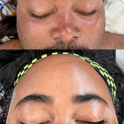 Diosa Glow Bar - Dermaplane facial
