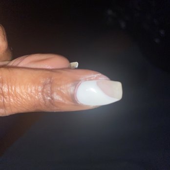 The Nail Bar & Lash - Huge piece of skin hanging off from puncture from overly aggressive nail filing - Nail Salons Near Me - Atlanta, Georgia The Nail Bar & Lash - Huge piece of skin hanging off from puncture from overly aggressive nail filing - Nail Salons Near Me - Atlanta, Georgia