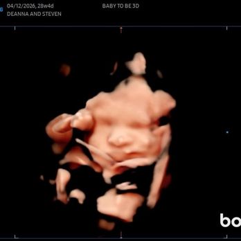 Baby To Be 3D - My son. An ultrasound Shannon did - Ultrasound Imaging Centers Near Me - Luzerne, Pennsylvania Baby To Be 3D - My son. An ultrasound Shannon did - Ultrasound Imaging Centers Near Me - Luzerne, Pennsylvania