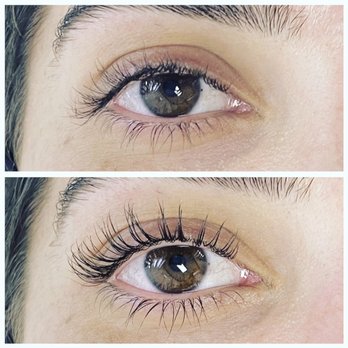 Waters Aesthetics - Skin Care Near Me - Phoenix, Arizona