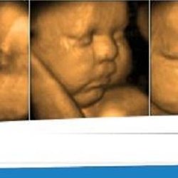 New Life Ultrasound - New Life Ultrasound