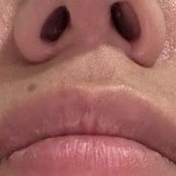 Dr Jay Calvert Plastic Surgery - Cosmetic Surgeons Near Me - Newport Beach, California Dr Jay Calvert Plastic Surgery - Cosmetic Surgeons Near Me - Newport Beach, California