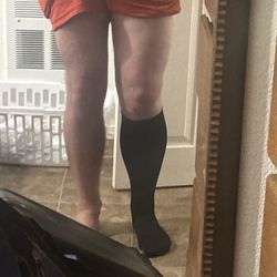 Michael Gustavel - Gustavel Orthopedics - 4 days post op.