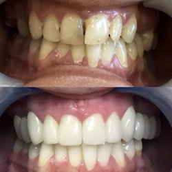 Kingston Family Cosmetic Dental Center - Cosmetic
Dentistry
Ceramic Crowns &
Ceramic Bridges &
Periodontal Treatment