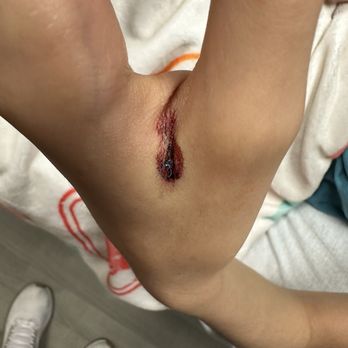 Memorial Hermann Cypress Hospital - Water she stitched him up supposedly - Hospitals Near Me - Cypress, Texas Memorial Hermann Cypress Hospital - Water she stitched him up supposedly - Hospitals Near Me - Cypress, Texas