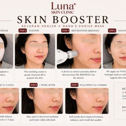 Skin Booster
