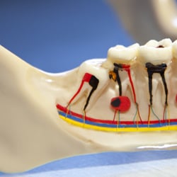 Steven E. Penn, DDS - Cracked Teeth in Davis, CA
