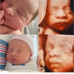 3D-4D Ultrasound Studio Queens