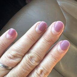 Nails grew out this much in a week because they didn't take the dip to the cuticle and they were already peeling up. Nails grew out this much in a week because they didn't take the dip to the cuticle and they were already peeling up.