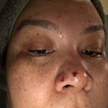 Dev Wali, MD Plastic Surgery-Medspa - Cosmetic Surgeons Near Me - Claremont, California