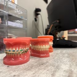 Crescent Orthodontics - We offer metal braces and clear aligner options