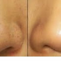 La La Beauty - Extraction satisfaction