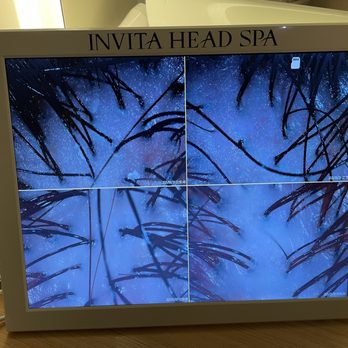 Invita Head Spa - Before and after scalp photos - Day Spas Near Me - Las Vegas, Nevada Invita Head Spa - Before and after scalp photos - Day Spas Near Me - Las Vegas, Nevada