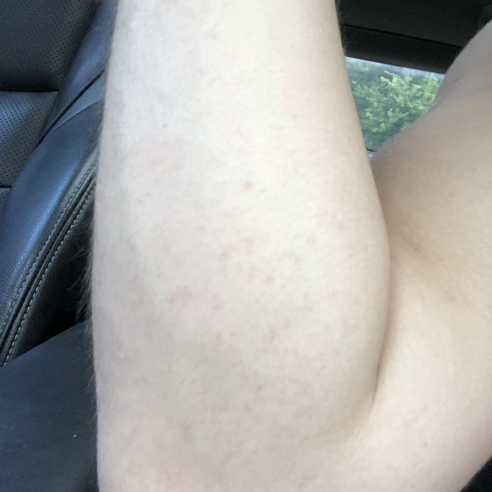 Texas Rowing Center - Fiber glass in my skin - Boating Near Me - Austin, Texas Texas Rowing Center - Fiber glass in my skin - Boating Near Me - Austin, Texas