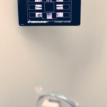 ABC Dental Care - DIGITAL x-rays from the Doctor's computer straight to the TV! - General Dentistry Near Me - Palmdale, California