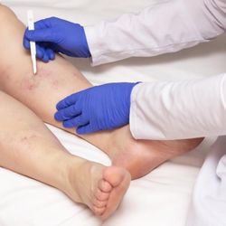 California Vein & Vascular Centers