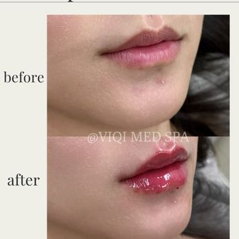VIQI Med Spa - Medical Spas Near Me - Alhambra, California