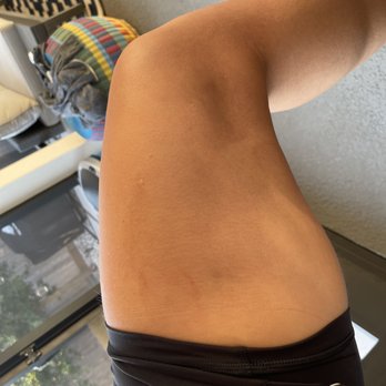 AirSculpt - Houston - Cosmetic Surgeons Near Me - Houston, Texas