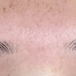 Eyebrow Centre - Very uneven